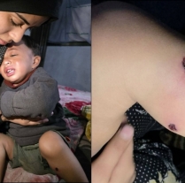 Izraelski vojaki v Gazi mučili 18-mesečnega dojenčka – na njemu ugašali cigarete in mu zabili žeblje v noge